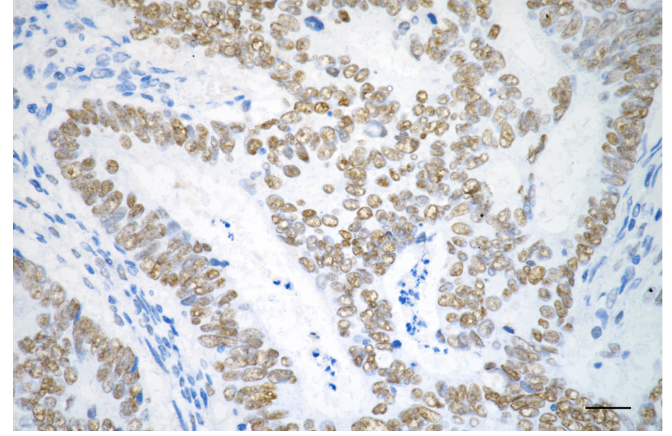 [KD Validated] Anti-CHEK2 Rabbit mAb [44L69H30]