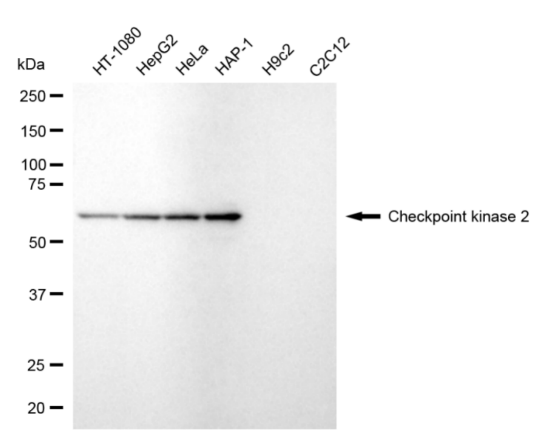 [KD Validated] Anti-CHEK2 Rabbit mAb [44L69H30]