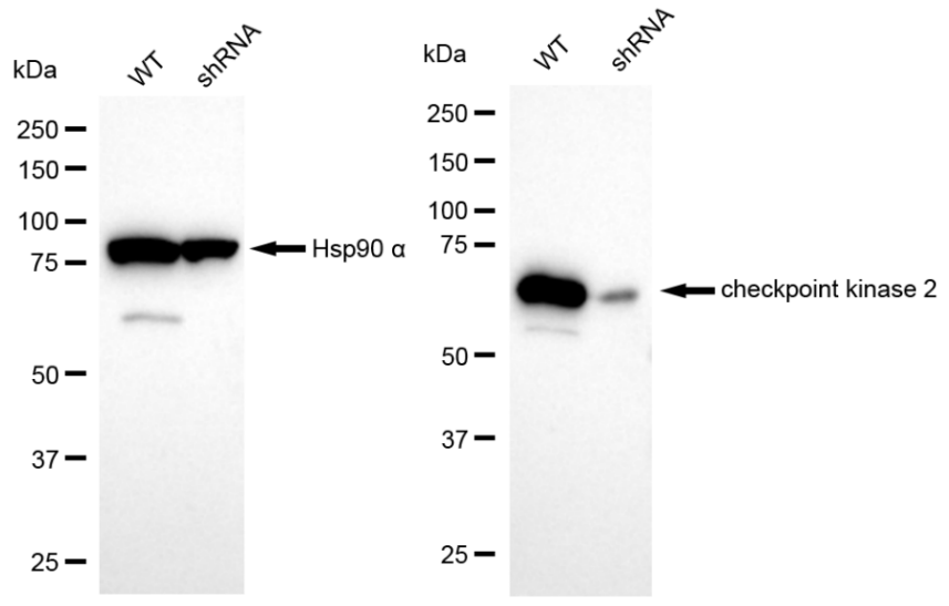 [KD Validated] Anti-CHEK2 Rabbit mAb [44L69H30]