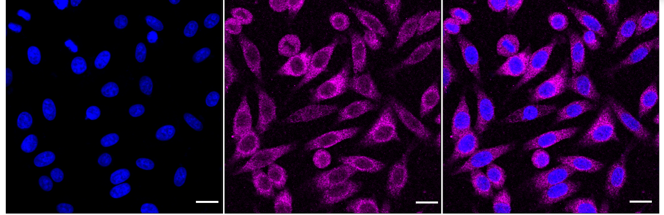 [KD Validated] Anti-BCL10 Rabbit mAb [15S14M18]