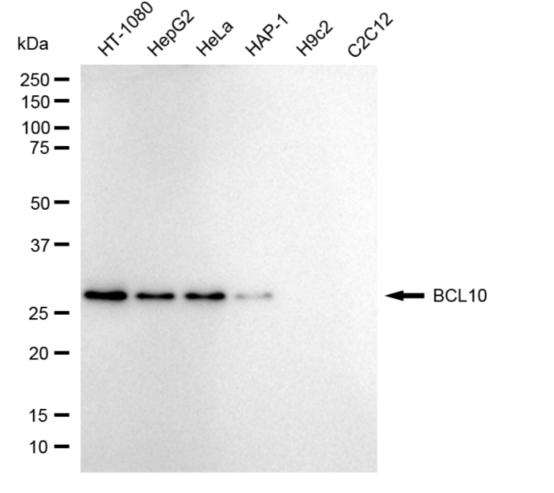 [KD Validated] Anti-BCL10 Rabbit mAb [15S14M18]
