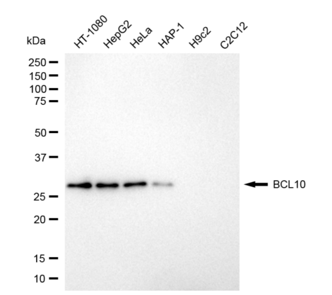 [KD Validated] Anti-BCL10 Rabbit mAb [78T30S26]