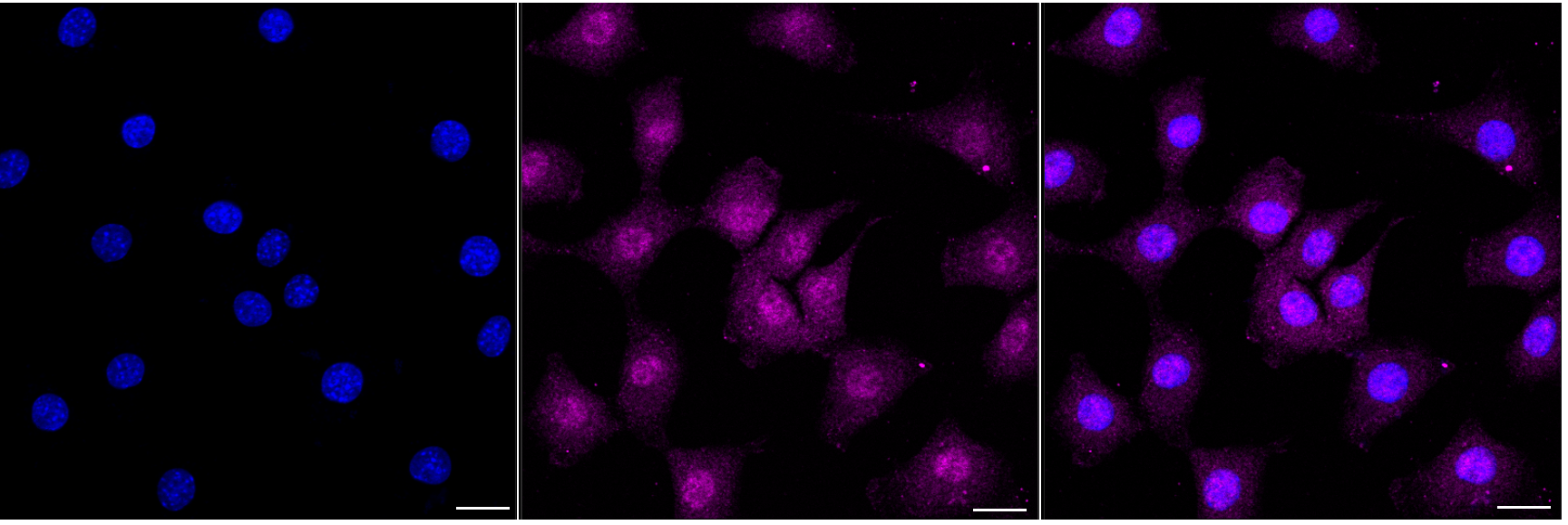 [KD Validated] Anti-EIF4EBP1 Rabbit mAb [70Q26M66]