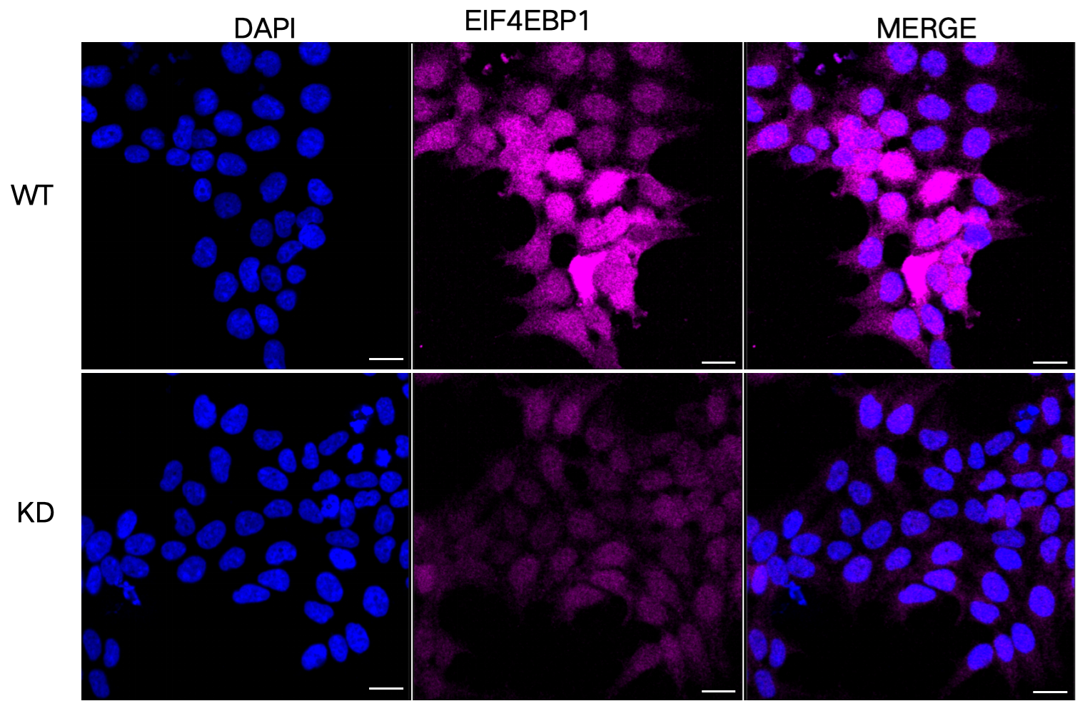 [KD Validated] Anti-EIF4EBP1 Rabbit mAb [70Q26M66]
