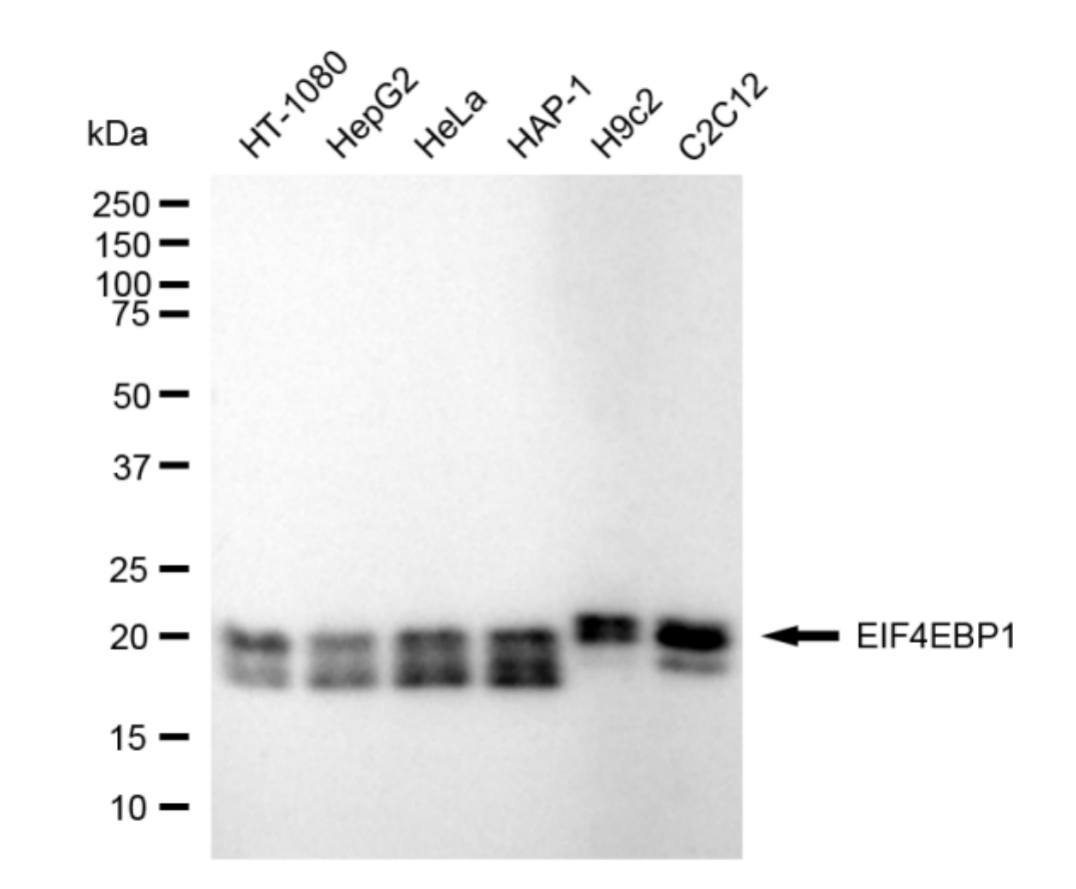 [KD Validated] Anti-EIF4EBP1 Rabbit mAb [70Q26M66]