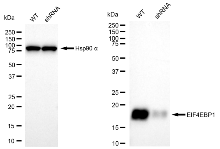 [KD Validated] Anti-EIF4EBP1 Rabbit mAb [70Q26M66]