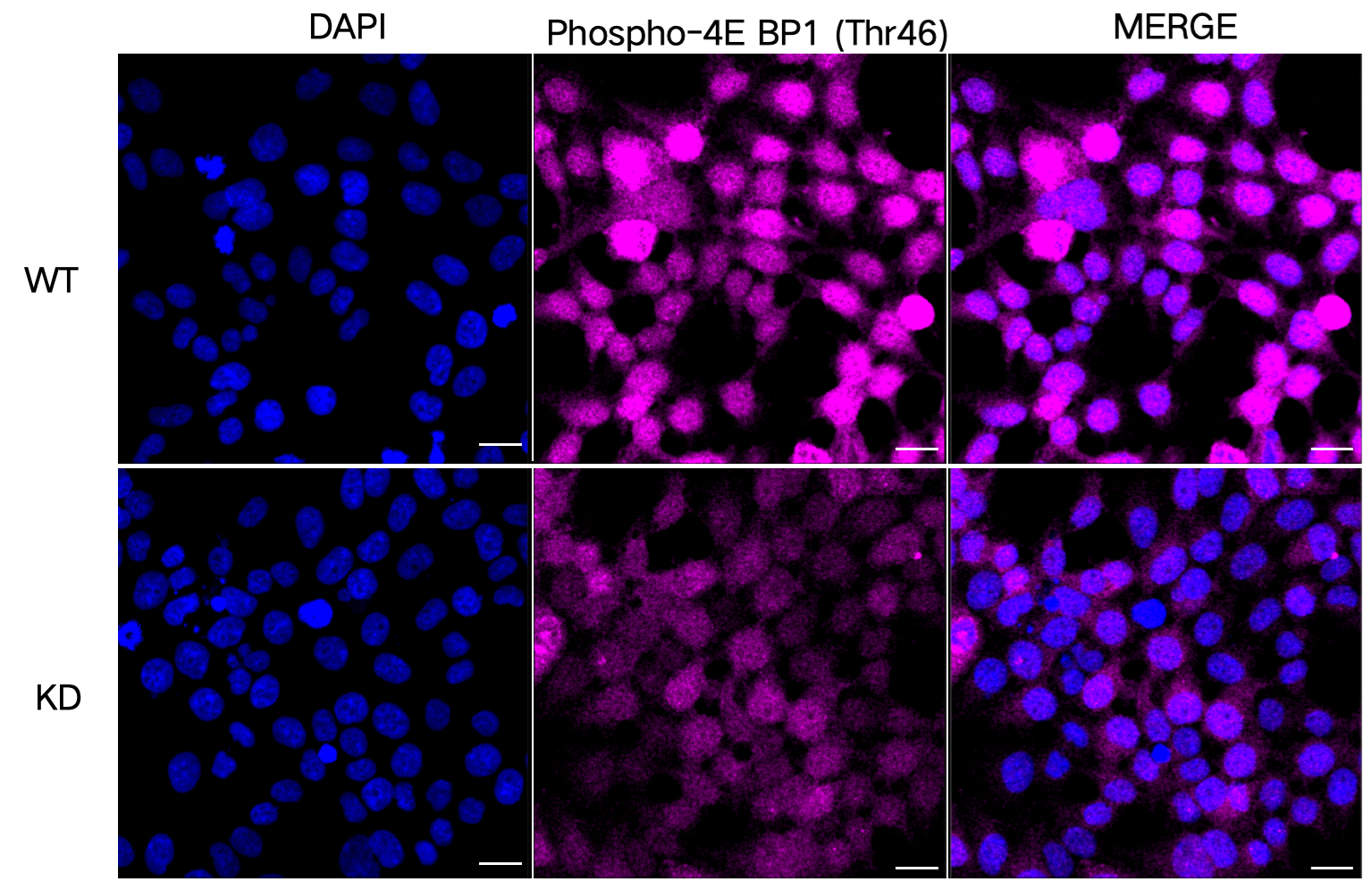 [KD Validated] Anti-EIF4EBP1 Rabbit mAb [21S74P12]