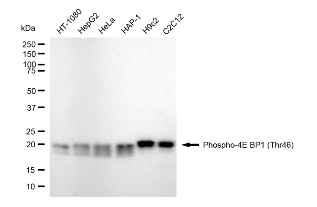[KD Validated] Anti-EIF4EBP1 Rabbit mAb [21S74P12]