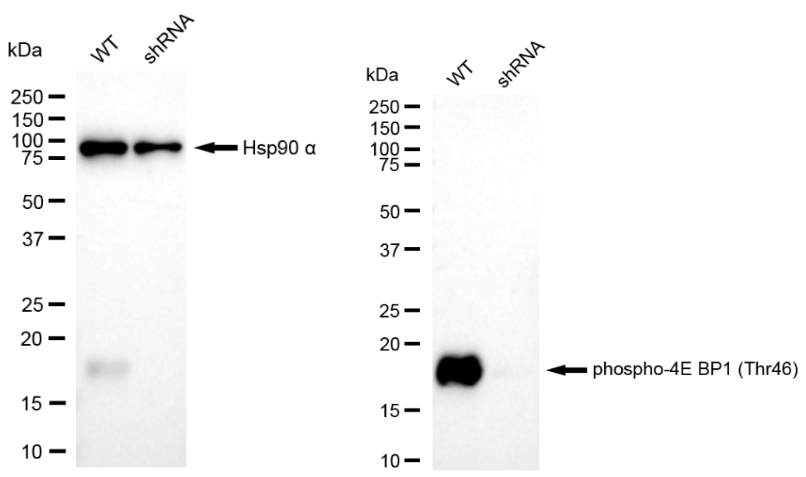 [KD Validated] Anti-EIF4EBP1 Rabbit mAb [21S74P12]