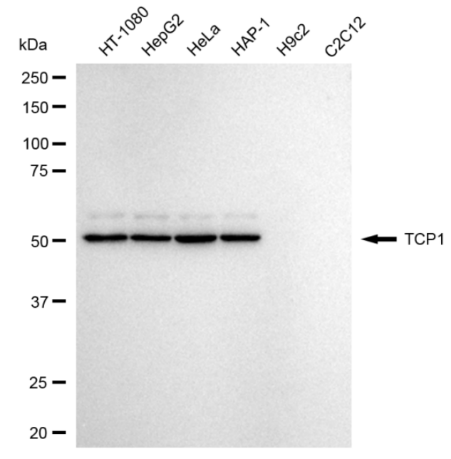 [KD Validated] Anti-TCP1 Rabbit mAb [65C12C68]