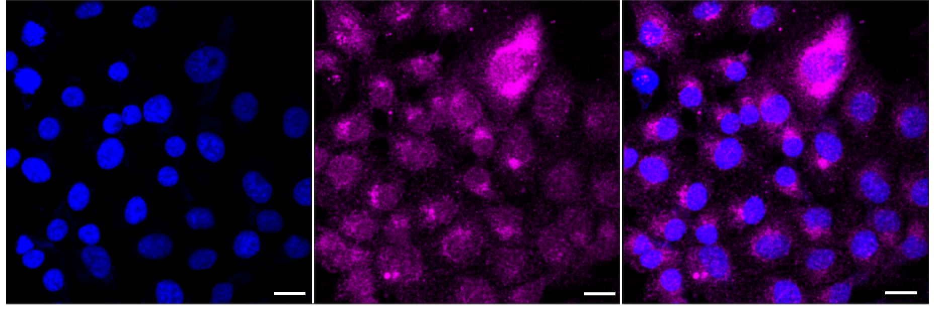 [KD Validated] Anti-SERPINE1 Rabbit mAb [25J41M41]