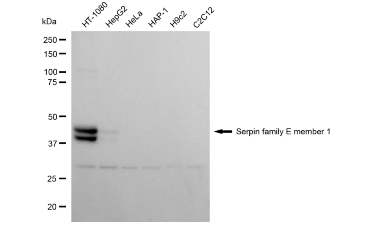[KD Validated] Anti-SERPINE1 Rabbit mAb [25J41M41]