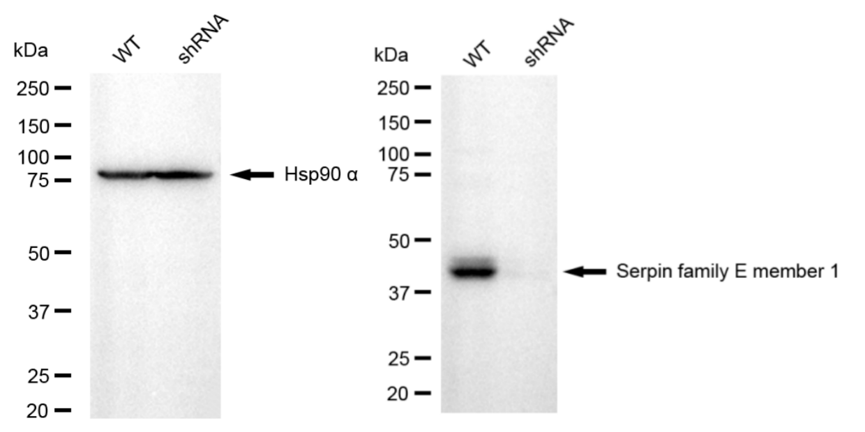 [KD Validated] Anti-SERPINE1 Rabbit mAb [25J41M41]