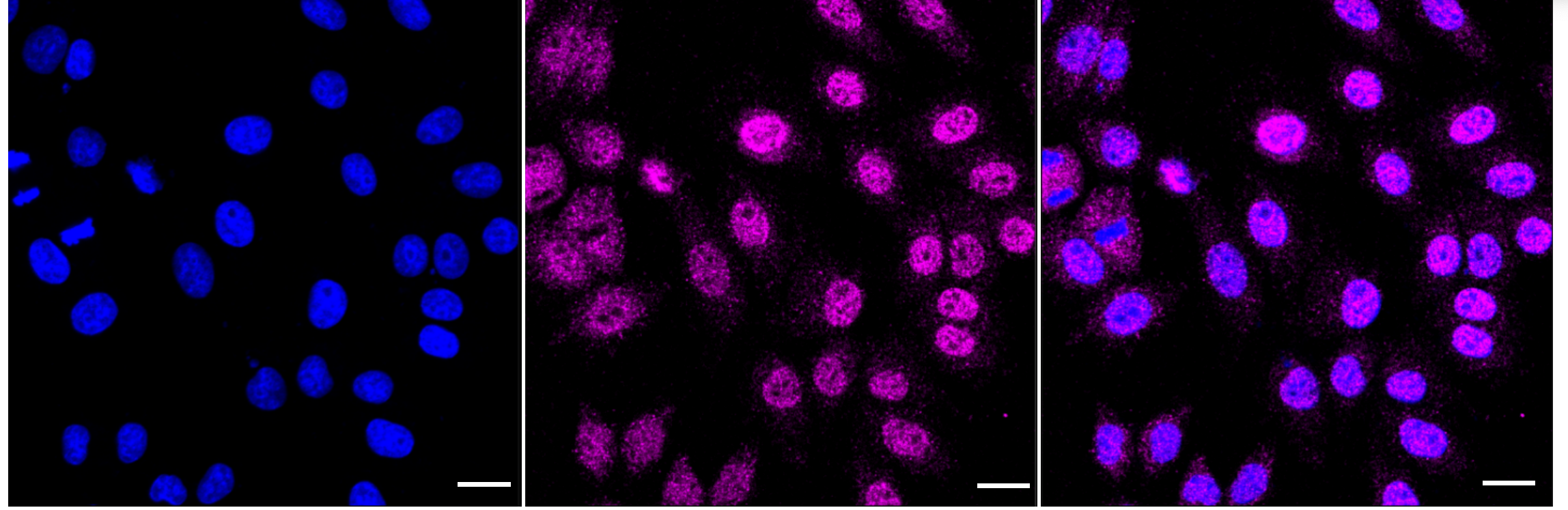 [KD Validated] Anti-MTOR Rabbit mAb [11D16G53]