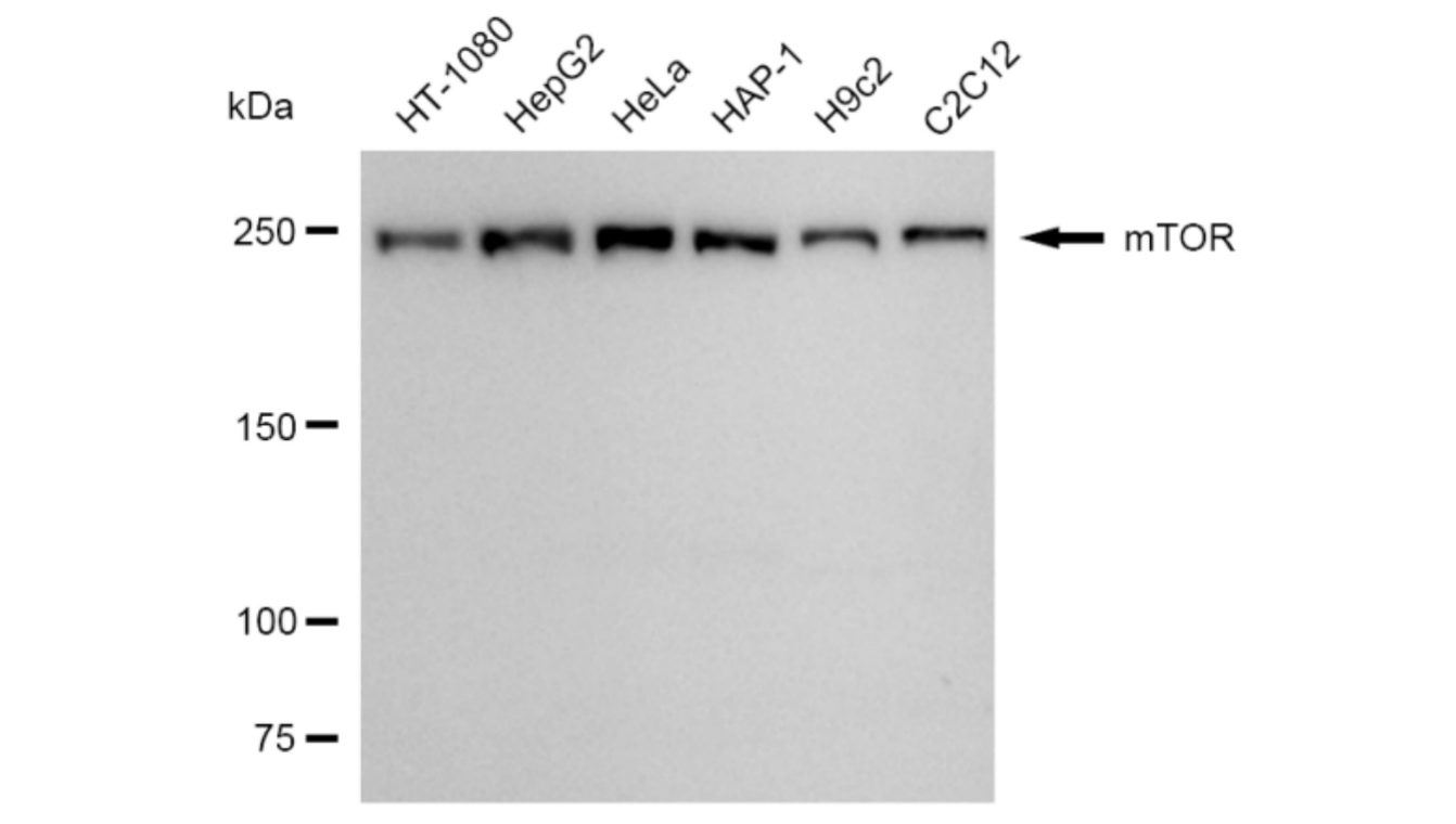 [KD Validated] Anti-MTOR Rabbit mAb [11D16G53]