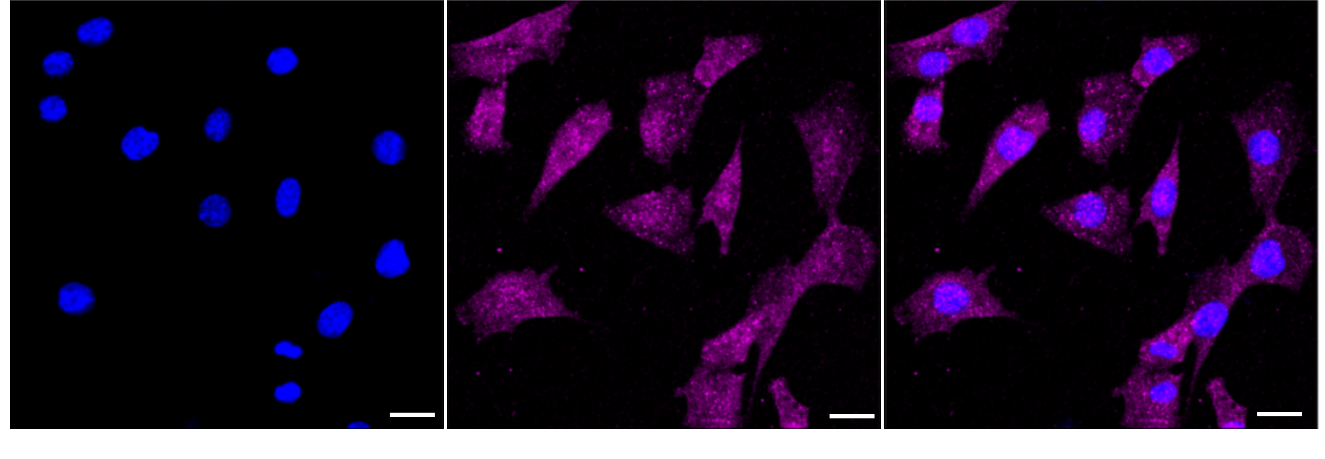 [KD Validated] Anti-MAPK1 Rabbit mAb [22D17E75]