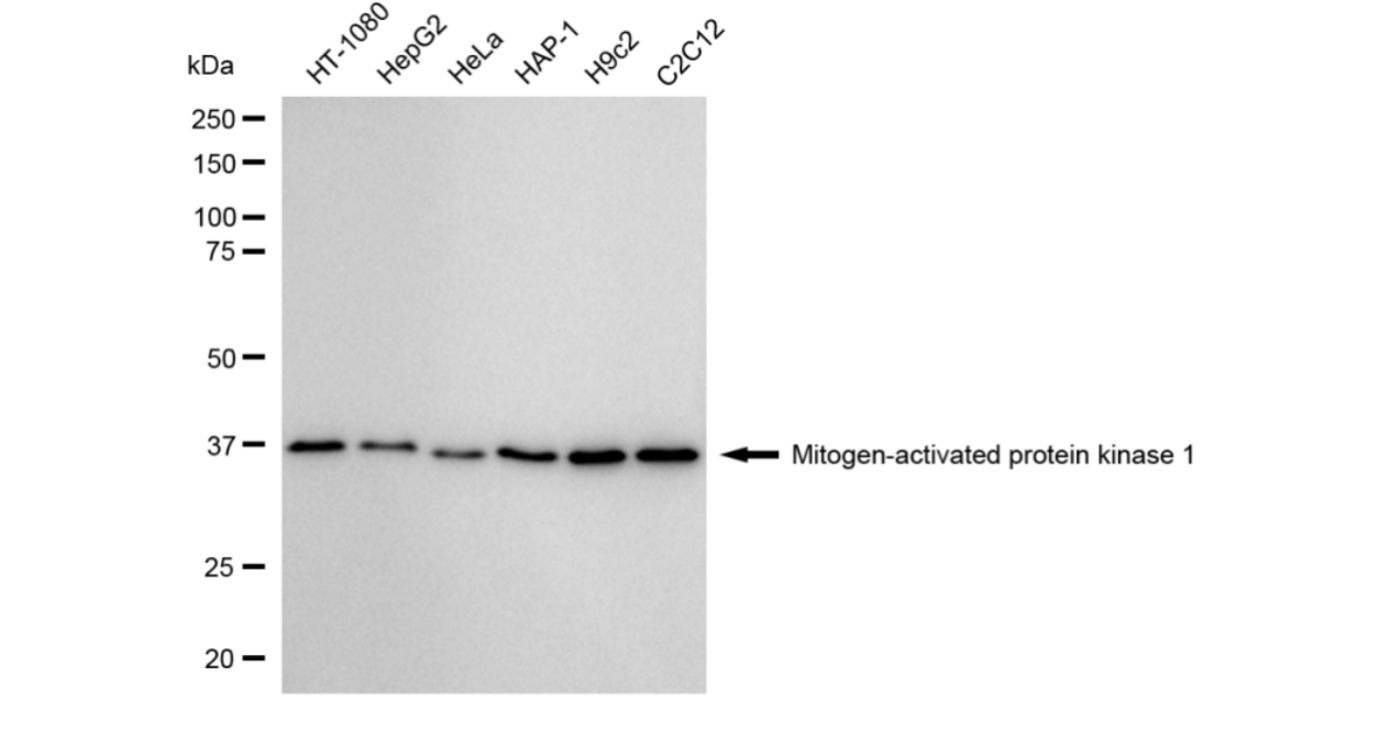 [KD Validated] Anti-MAPK1 Rabbit mAb [22D17E75]
