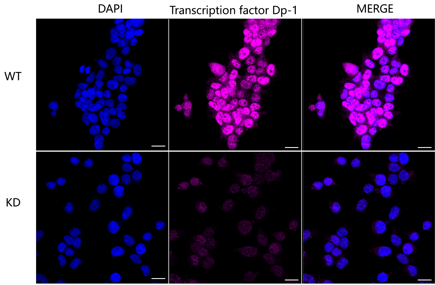 [KD Validated] Anti-TFDP1 Rabbit mAb [51N72B41]