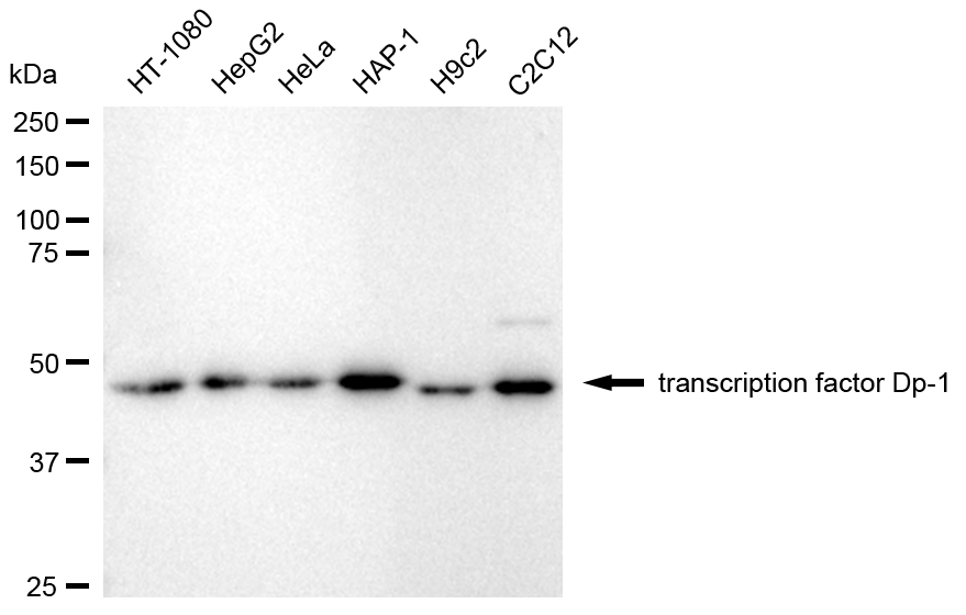 [KD Validated] Anti-TFDP1 Rabbit mAb [51N72B41]