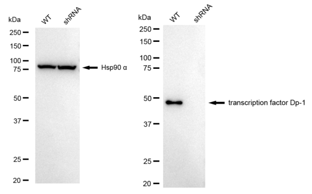[KD Validated] Anti-TFDP1 Rabbit mAb [51N72B41]