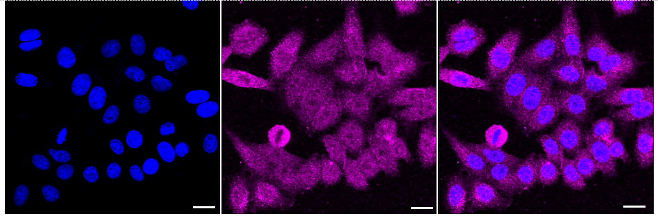 [KD Validated] Anti-VEGFD Rabbit mAb [36S60E87]