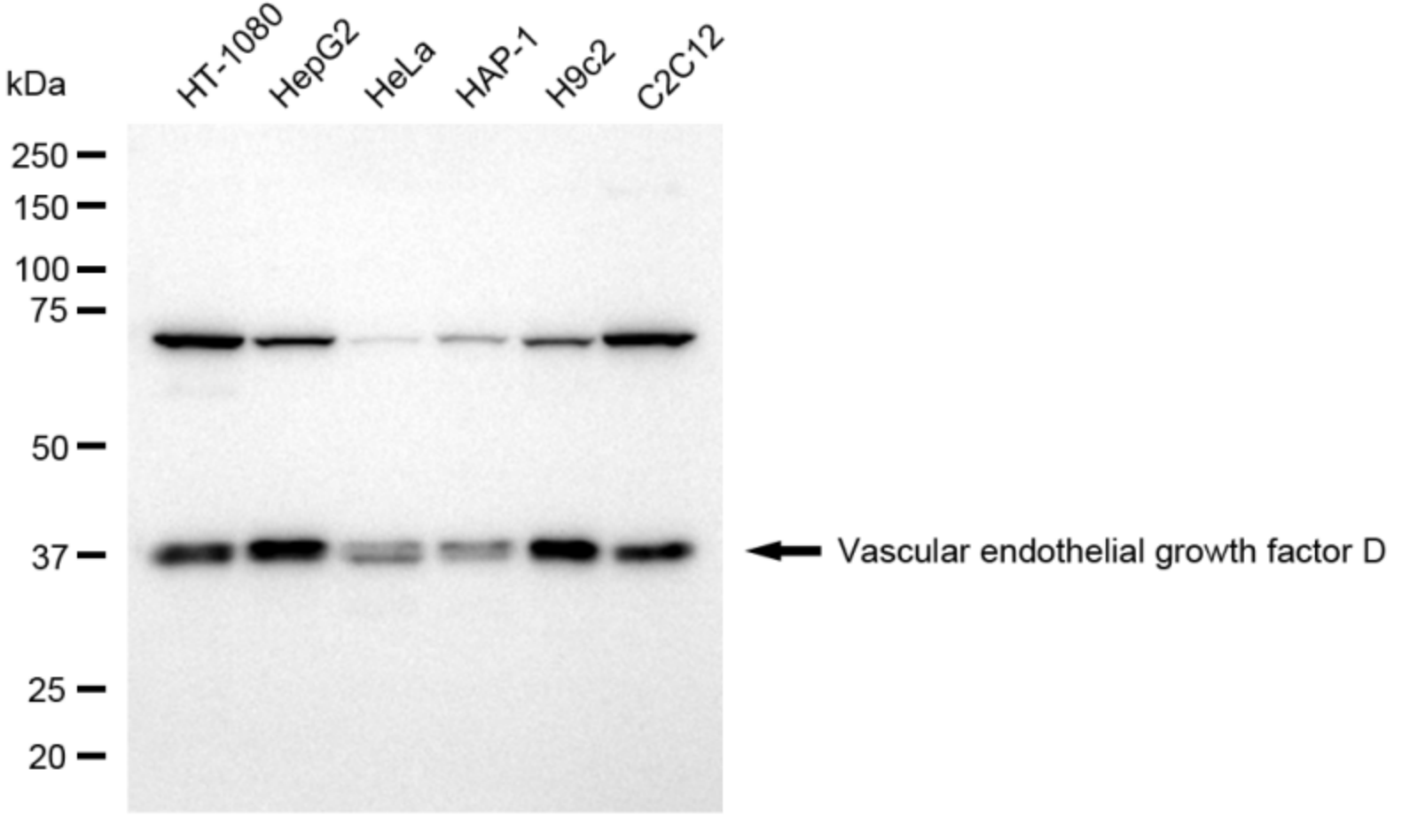 [KD Validated] Anti-VEGFD Rabbit mAb [36S60E87]