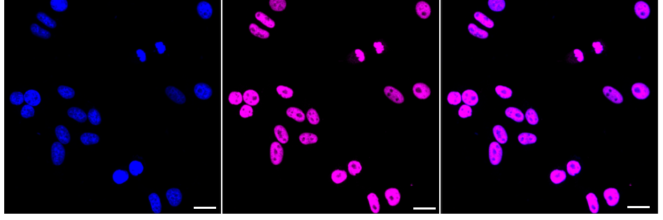 [KD Validated] Anti-SMARCA4 Rabbit mAb [18T80C32]