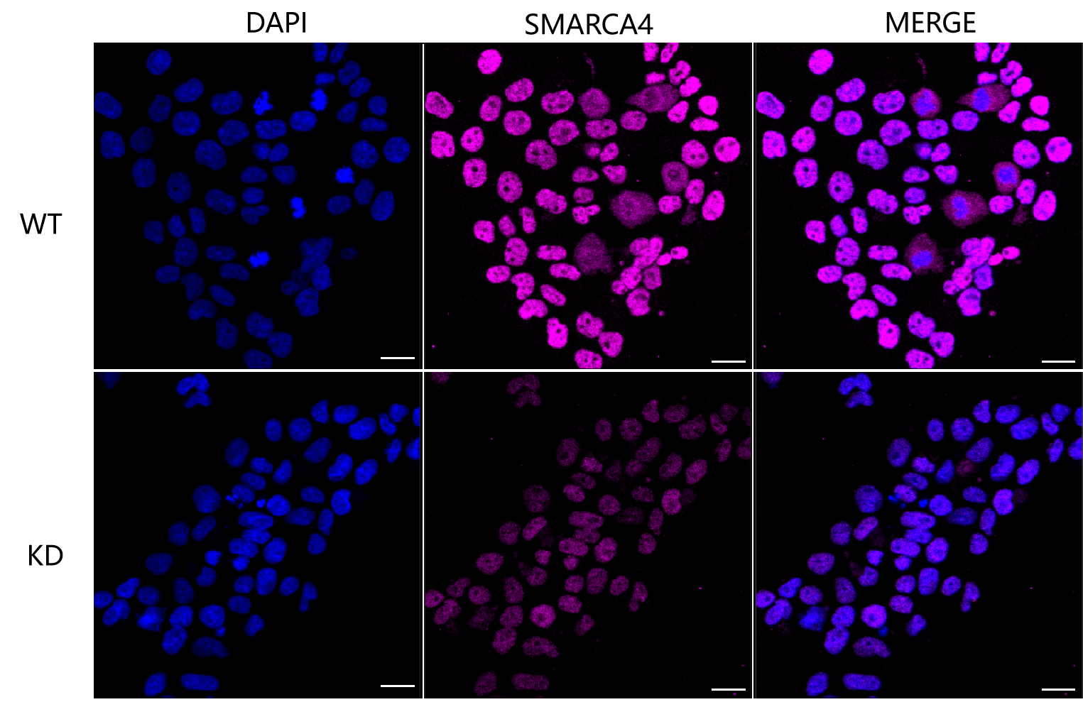 [KD Validated] Anti-SMARCA4 Rabbit mAb [18T80C32]