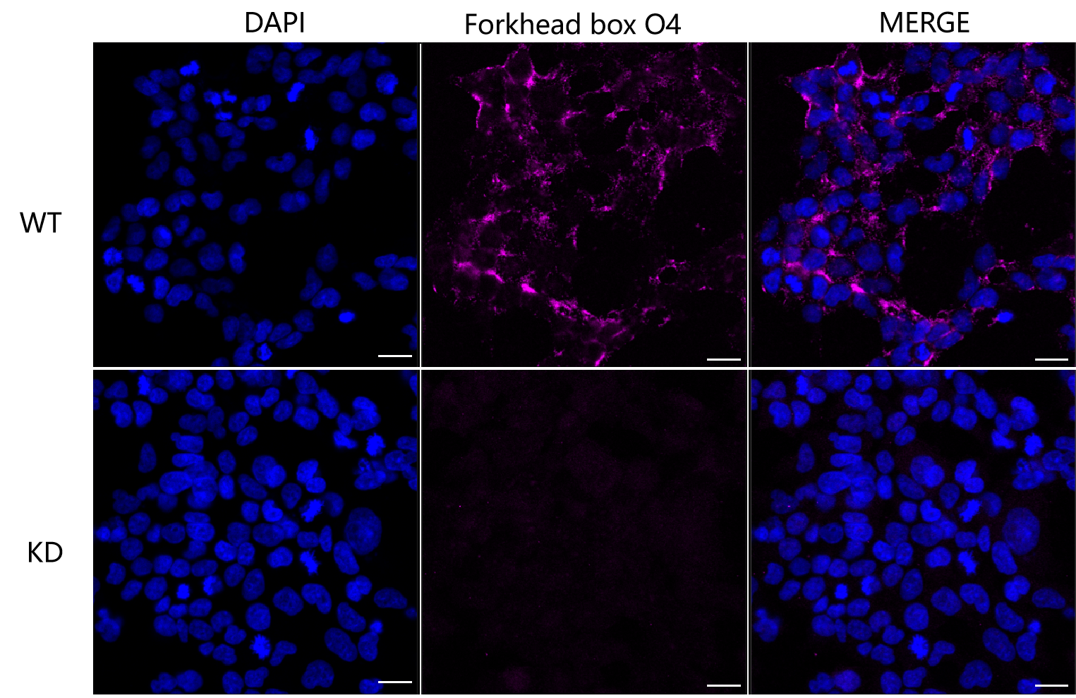 [KD Validated] Anti-FOXO4 Rabbit mAb [90M80G67]