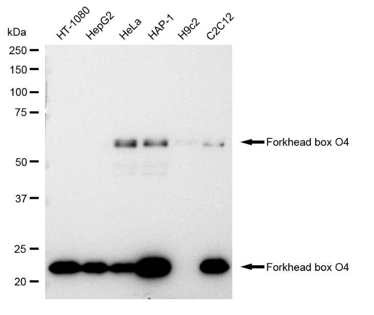 [KD Validated] Anti-FOXO4 Rabbit mAb [90M80G67]