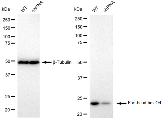 [KD Validated] Anti-FOXO4 Rabbit mAb [90M80G67]