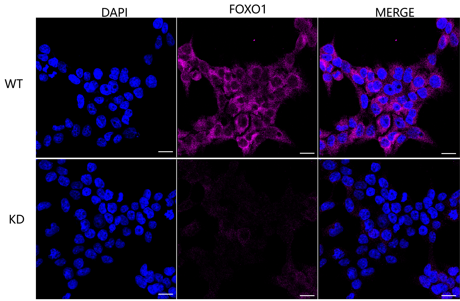 [KD Validated] Anti-FOXO1 Rabbit mAb [41Q79S76]