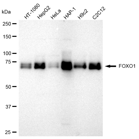 [KD Validated] Anti-FOXO1 Rabbit mAb [41Q79S76]