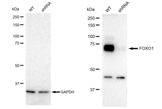 [KD Validated] Anti-FOXO1 Rabbit mAb [41Q79S76]