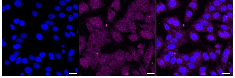[KD Validated] Anti-RAD21 Rabbit mAb [65A44S90]
