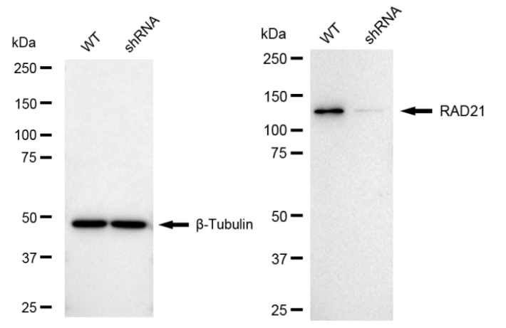 [KD Validated] Anti-RAD21 Rabbit mAb [65A44S90]
