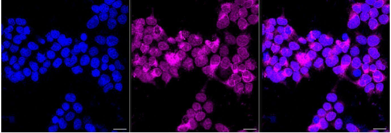 [KD Validated] Anti-PRKCSH Rabbit mAb [57A94F85]
