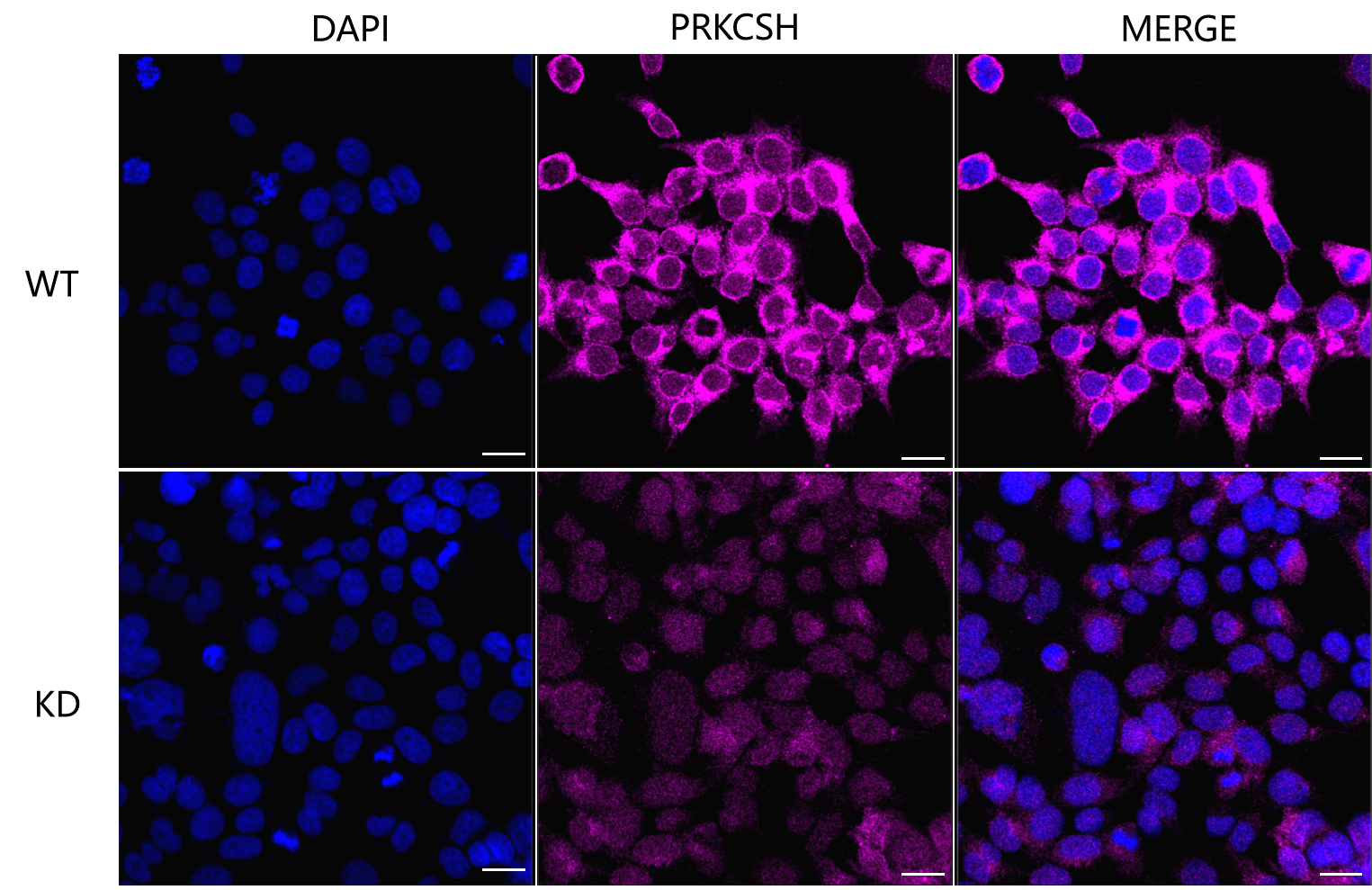 [KD Validated] Anti-PRKCSH Rabbit mAb [57A94F85]
