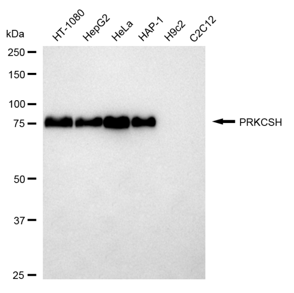 [KD Validated] Anti-PRKCSH Rabbit mAb [57A94F85]