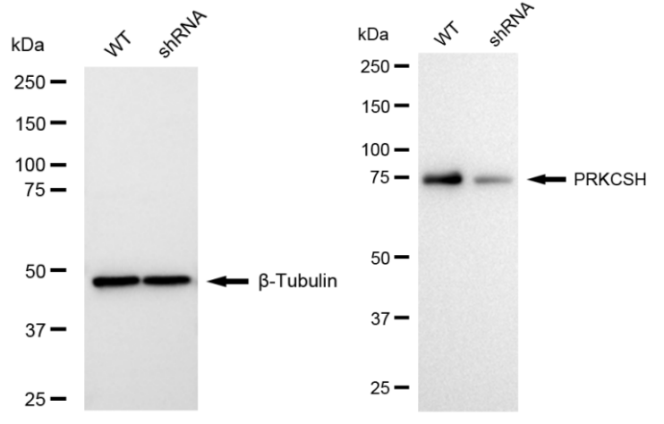 [KD Validated] Anti-PRKCSH Rabbit mAb [57A94F85]