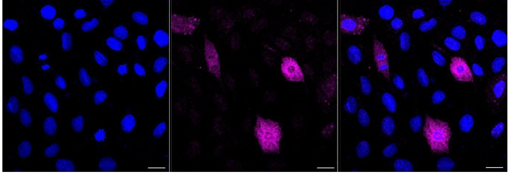 [KD Validated] Anti-PLCB3 Rabbit mAb [22P39Q97]