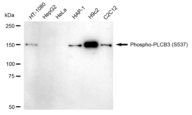 [KD Validated] Anti-PLCB3 Rabbit mAb [22P39Q97]