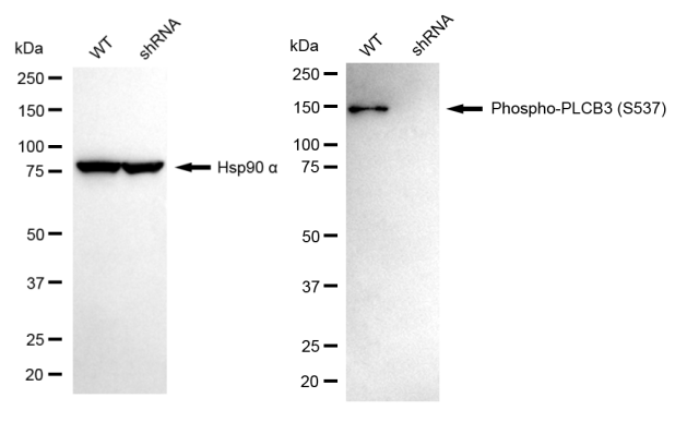 [KD Validated] Anti-PLCB3 Rabbit mAb [22P39Q97]