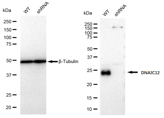 [KD Validated] Anti-DNAJC12 Rabbit mAb [49Q23N66]