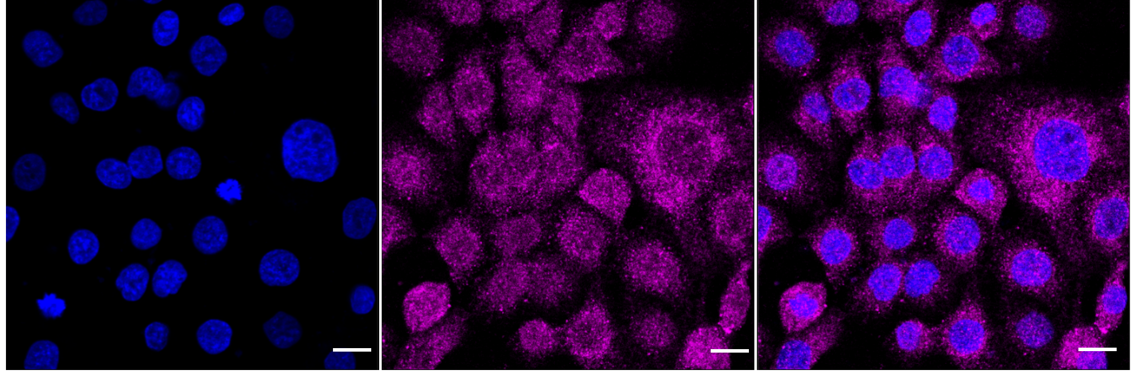 [KD Validated] Anti-RARA Rabbit mAb [81D73H54]