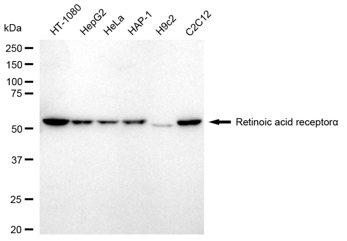[KD Validated] Anti-RARA Rabbit mAb [81D73H54]