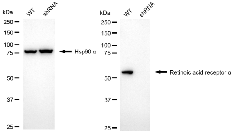 [KD Validated] Anti-RARA Rabbit mAb [81D73H54]