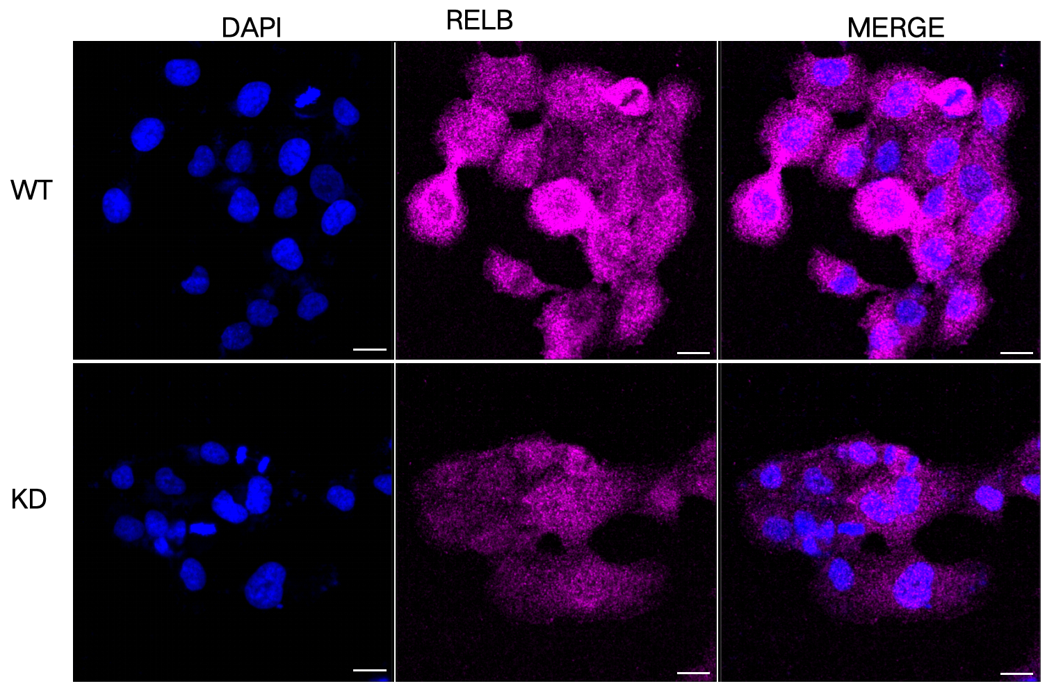 [KD Validated] Anti-RELB Rabbit mAb [50D62M31]