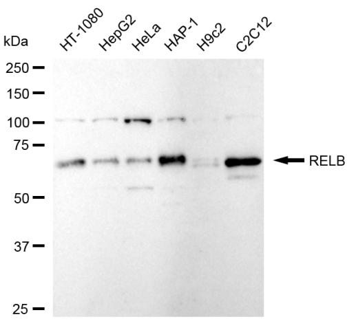 [KD Validated] Anti-RELB Rabbit mAb [50D62M31]