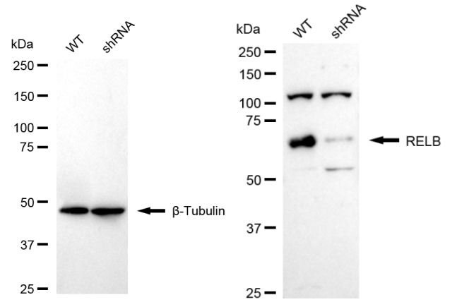 [KD Validated] Anti-RELB Rabbit mAb [50D62M31]